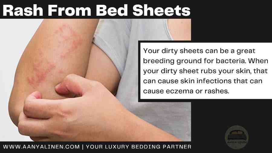 What does a plant rash look like?